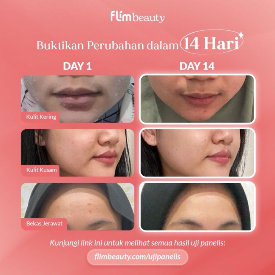 Flimcol Strawberry Minuman Collagen 10sachets