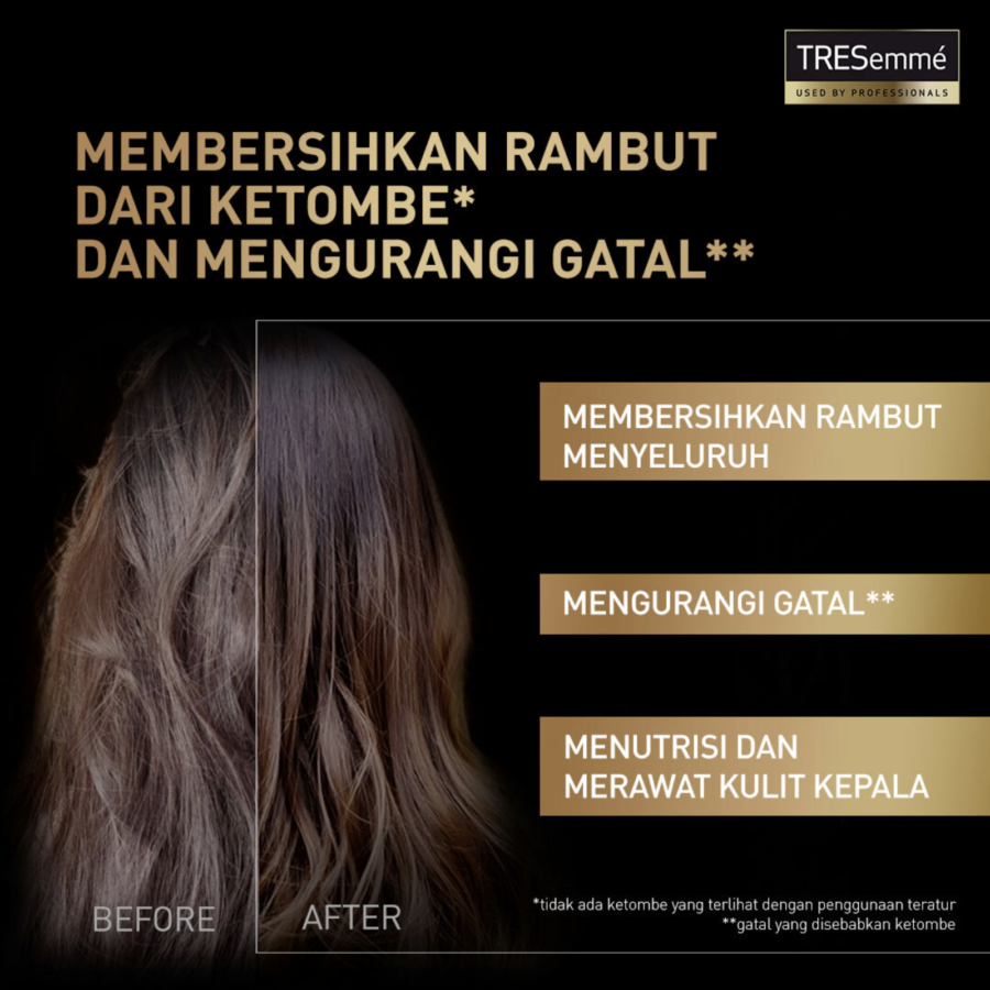 Tresemme Scalp Care Anti Dandruff Shampoo 170ml