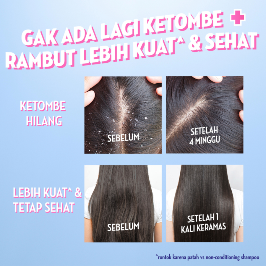 Sunsilk Shampoo Anti Ketombe Rambut Sehat dan Kuat 320ml
