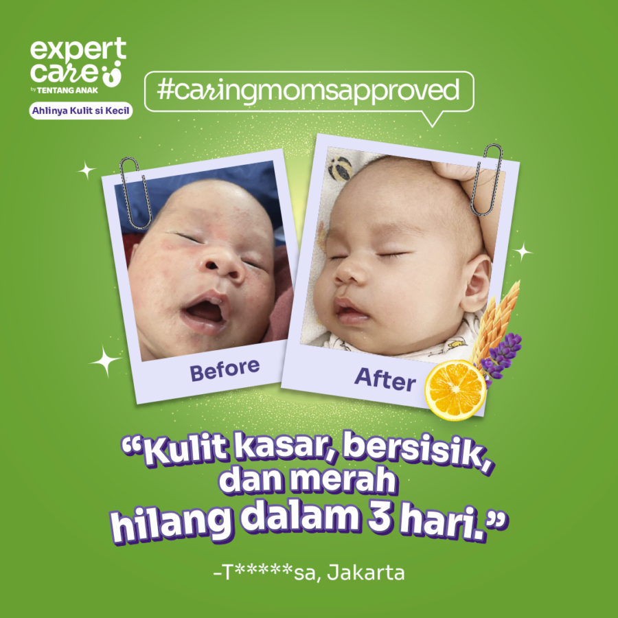 Expert Care Daily prOATect Shooting & Calming Cream Perawatan Bayi 150gram