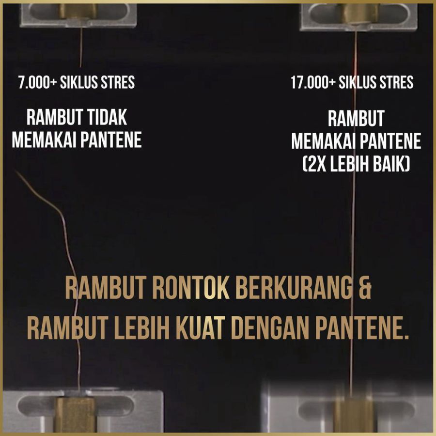 Pantene Pro-V 2in 1 Anti Ketombe & Perawatan Rontok Shampoo 400ml