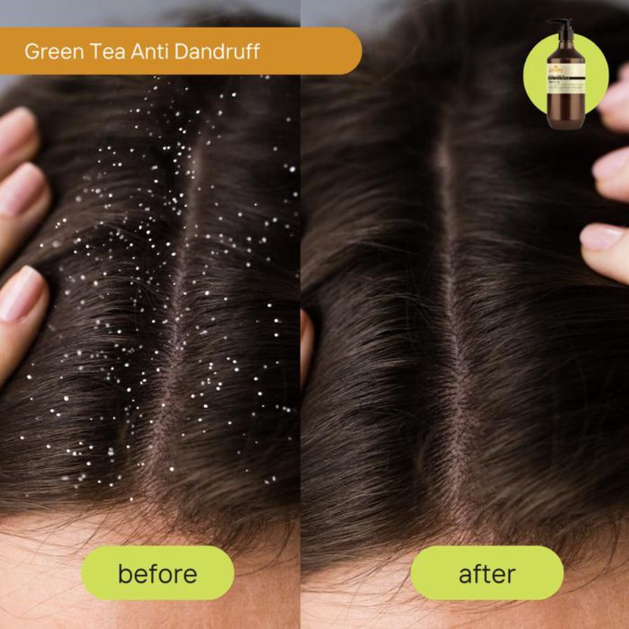 Dancoly Green Tea Anti Dandruff Shampoo 250ml