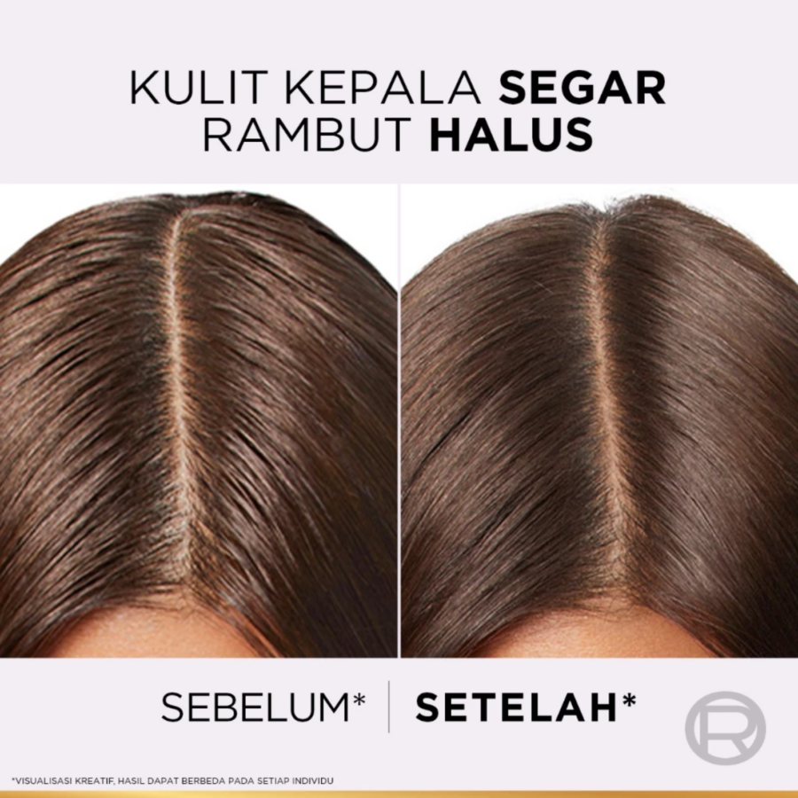 L'Oreal Paris Elseve Hyaluron Pure Pure Shampoo 400ml