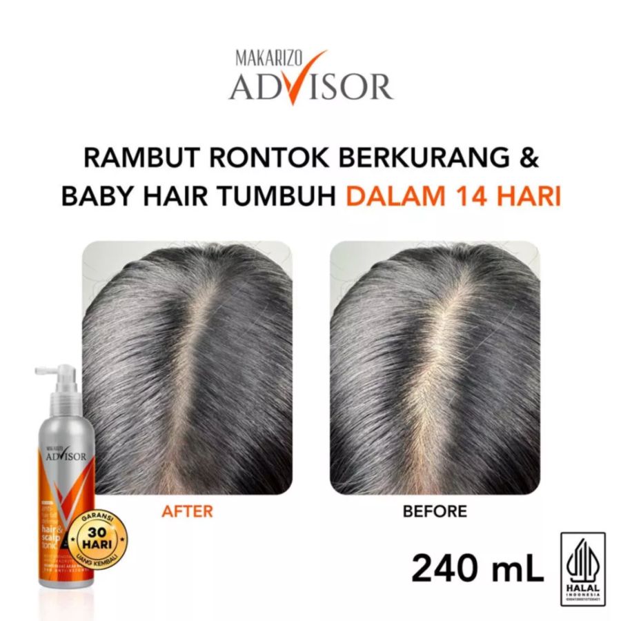 Makarizo Advisor Anti Hairfall Defense Hair & Scalp Tonic Perawatan Rambut 240ml