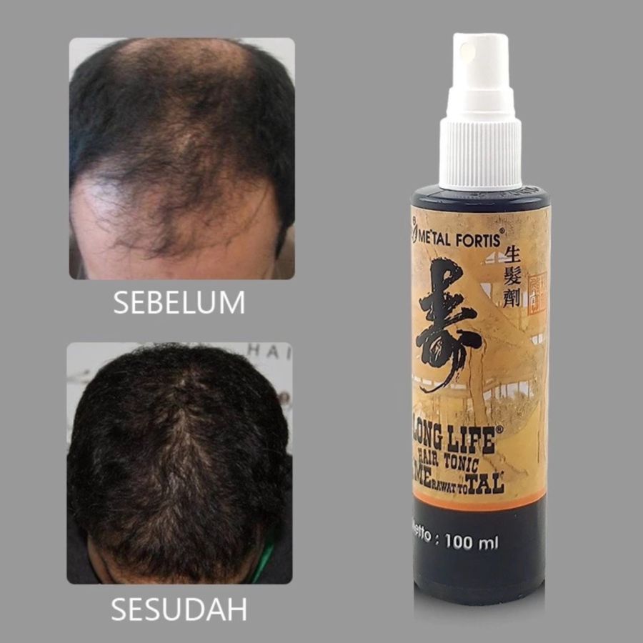 Metal Fortis Longlife Hair Tonic Perawatan Rambut 100ml