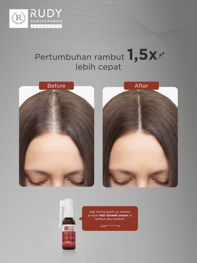 Rudy Hadisuwarno Cosmetics Hair Growth Serum 30ml