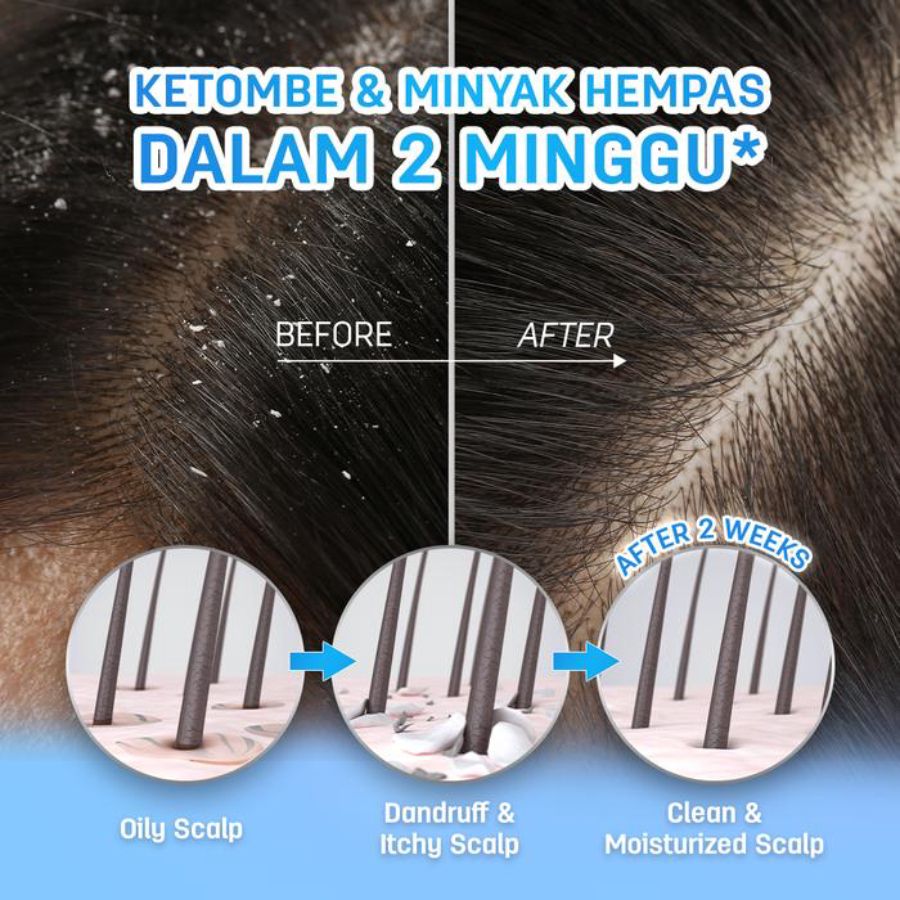 Erhair Scalperfect BHA & Allantoin Scalp Exfoliating Gel Perawatan Rambut 30gram