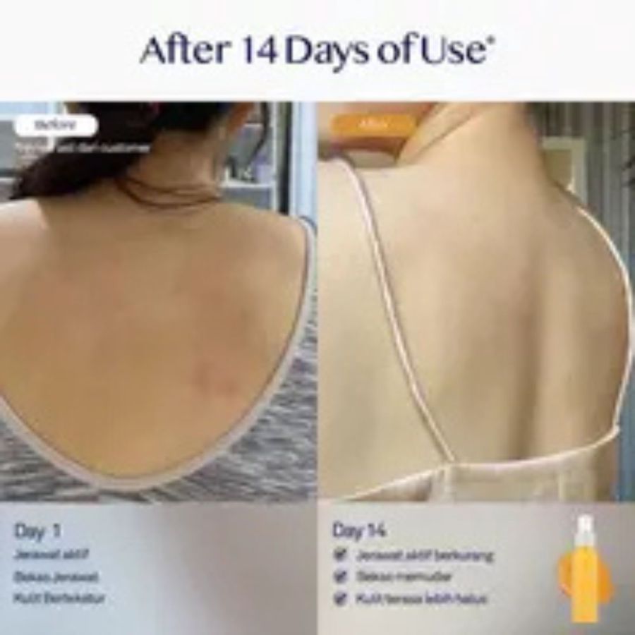 Rei Skin Betel Leaf + Glycolic Acid Body Acne Spray 100ml