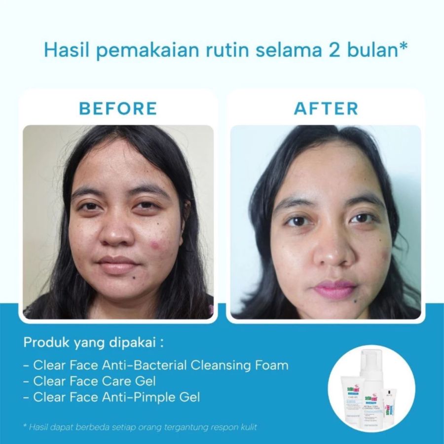 Sebamed Clear Face - Foam 150ml