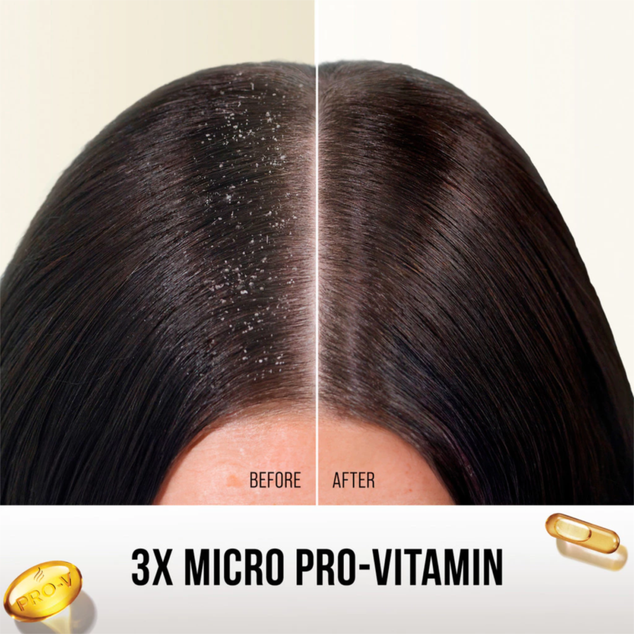 Pantene Pro V 2in1 Anti Ketombe & Perawatan Rambut Rontok Shampoo 990ml