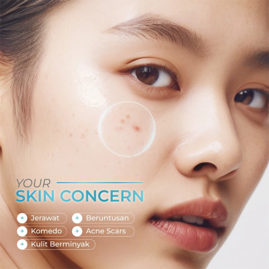 Wardah Acnederm Salicylic Acid Zinc Acne Clearing Low pH Foaming Cleanser 100ml