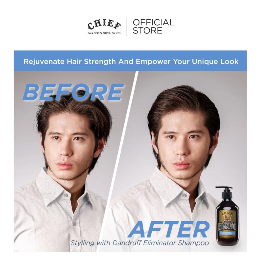 Chief Dandruff Eliminator Shampoo 400ml