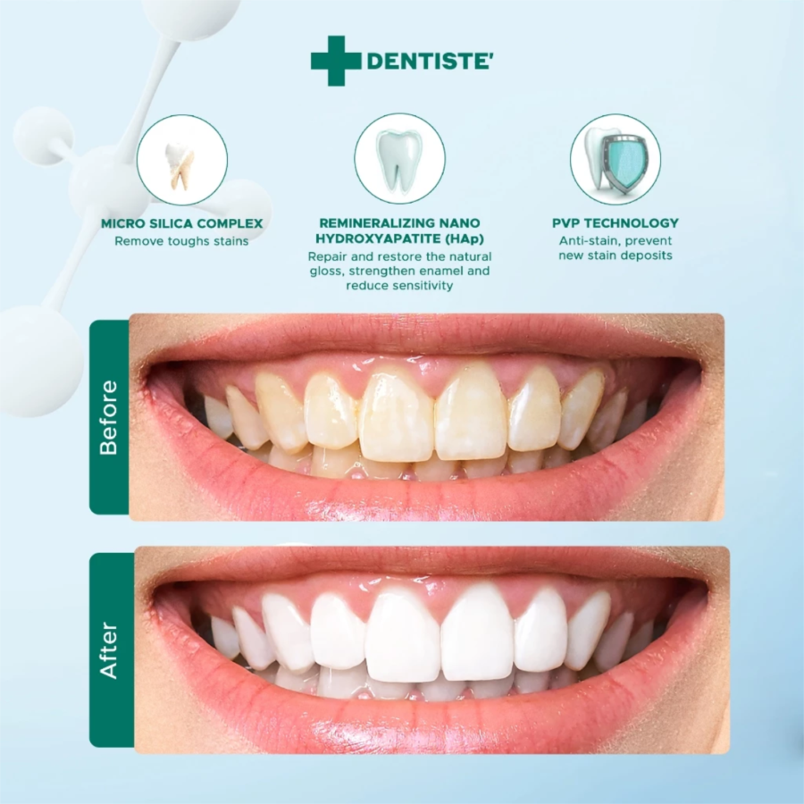 Dentiste Premium & Natural White Toothpaste 100gram