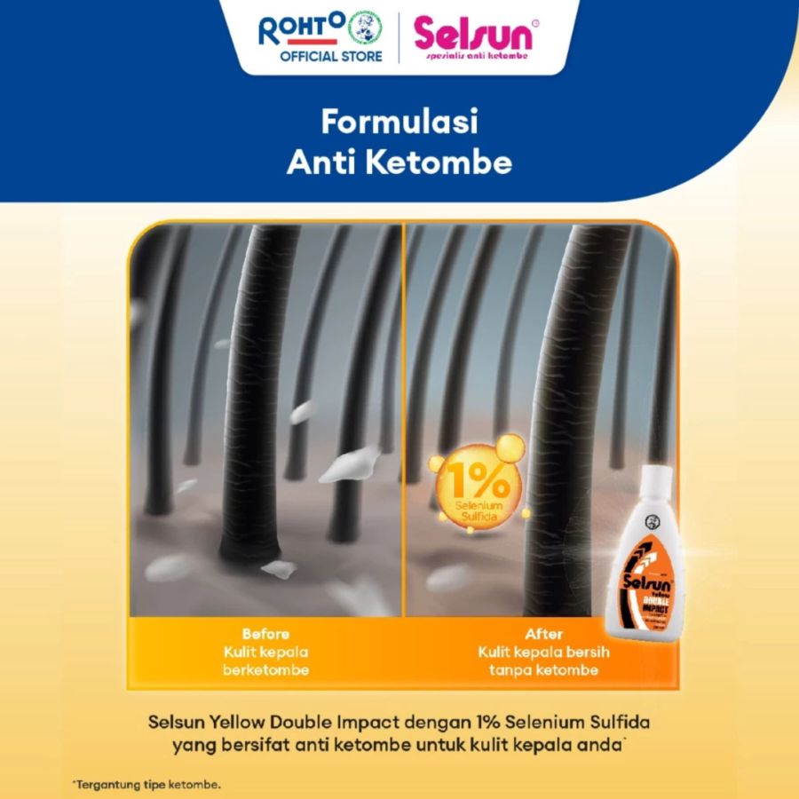 Selsun Shampoo Yelow Double Impact - Sampo Anti Ketombe 100ml