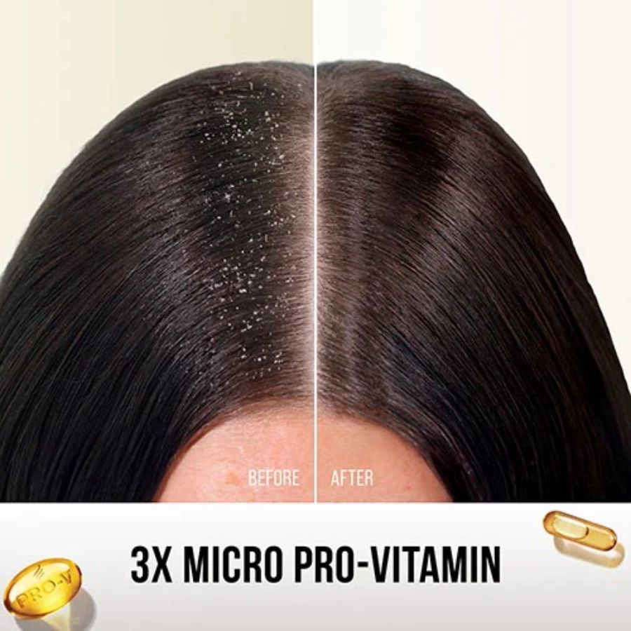 Pantene Pro-V 2in 1 Anti Ketombe & Perawatan Rontok Shampoo 750ml