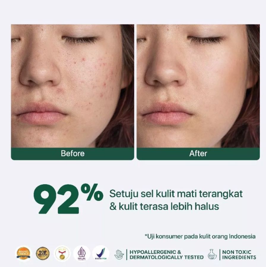 Acne Clear Pad Cica Kapas Eksfoliasi Wajah Sachet 1pack