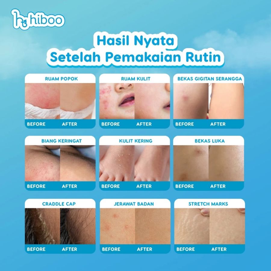 Hiboo All Purpose Baby Balm 5gram