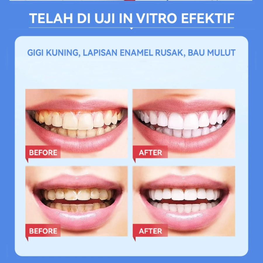 Sopami SP7 Pro Paket Combo Siang & Malam Toothpaste 240gram