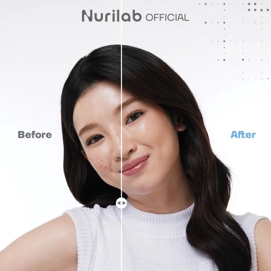 Nurilab Acne Conclearing Spot Drying Lotion 08 Cool Obat Totol Jerawat 2gram