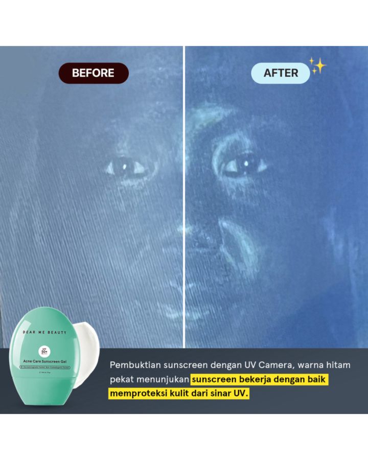 Dear Me Beauty Acne Care Sunscreen Gel Spf 50+ Pa++++ 1pcs