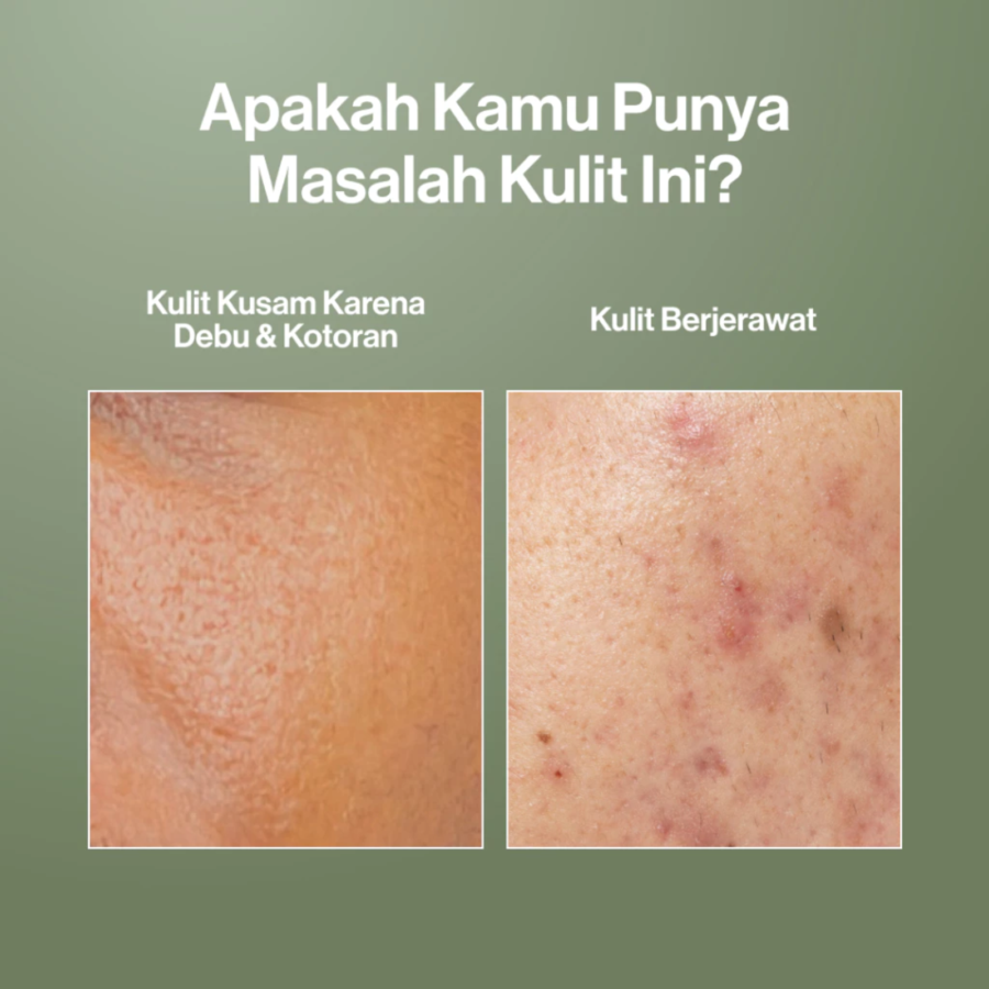 Kahf Acne & Pore Cleanse Scrub Face Wash 100ml