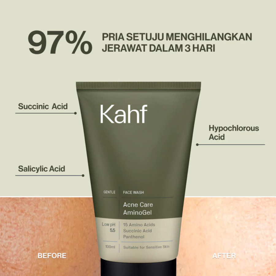 Kahf Acne Care Amino Gel Face Wash 100ml