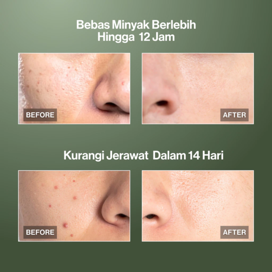Kahf Oil & Acne Care Face Wash 100ml