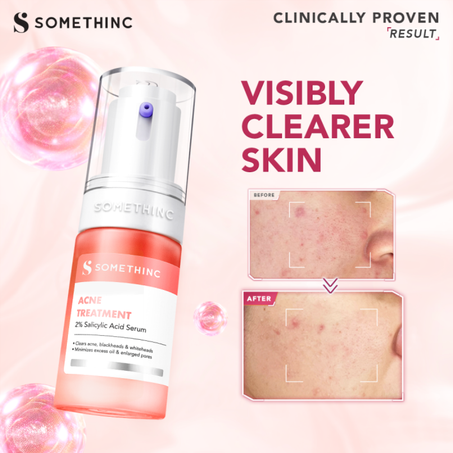 Somethinc Acne Treatment Serum Wajah 20ml