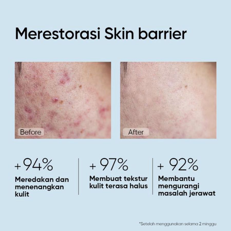 Skintific 5x Ceramide Barrier Serum 50ml