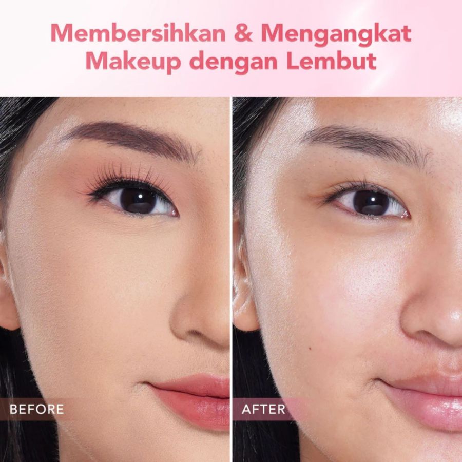 The Originote Hyalurose Micellar Water Make Up Remover 300ml
