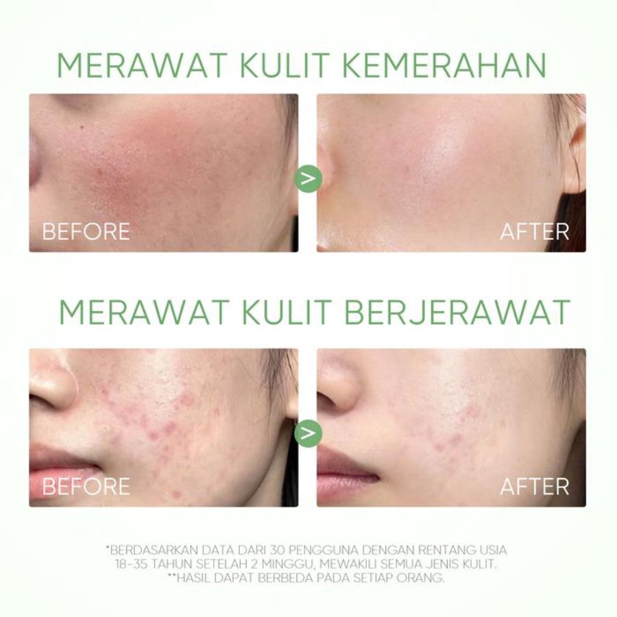 Skintific Mugwort Anti Pores and Acne Clay Masker Wajah 40gram