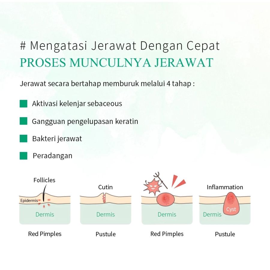 Breylee Acne Treatment Cream 20gram