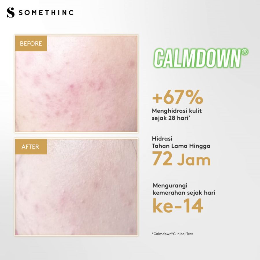 Somethinc Calm Down Skinpair R-Cover Cream 50gram