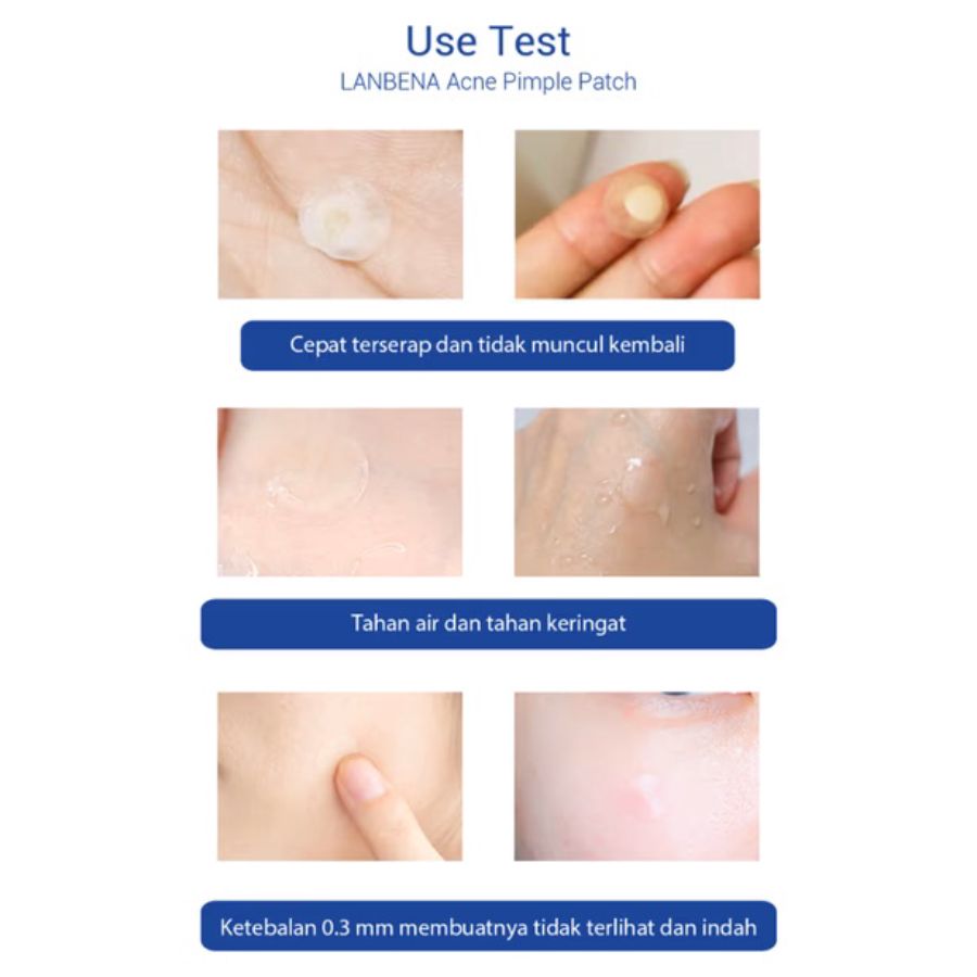 Lanbena Acne Pimple Patch Night 28patch