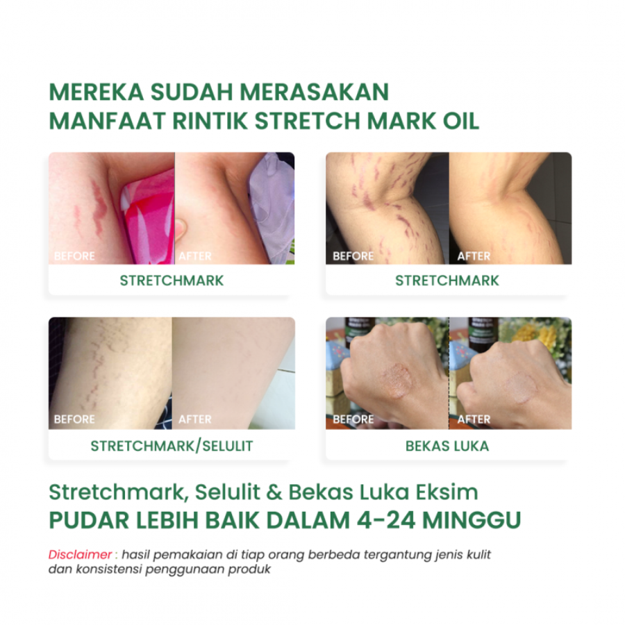 Rintik Skincare Stretch Mark Oil 90ml