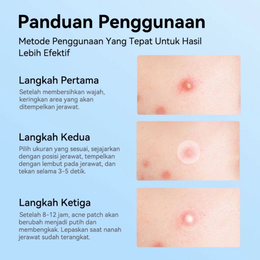 Focalskin Acne Care Day & Night Acne Patch 60patch