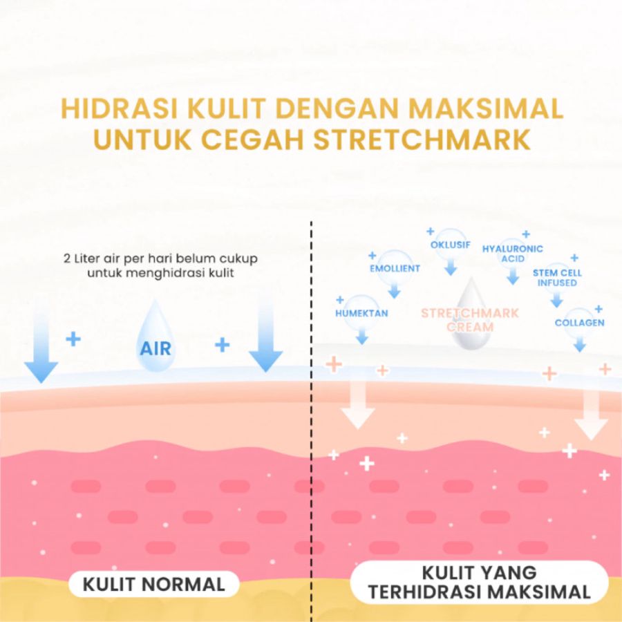 Rintik Skincare Stretchmark Cream 200ml