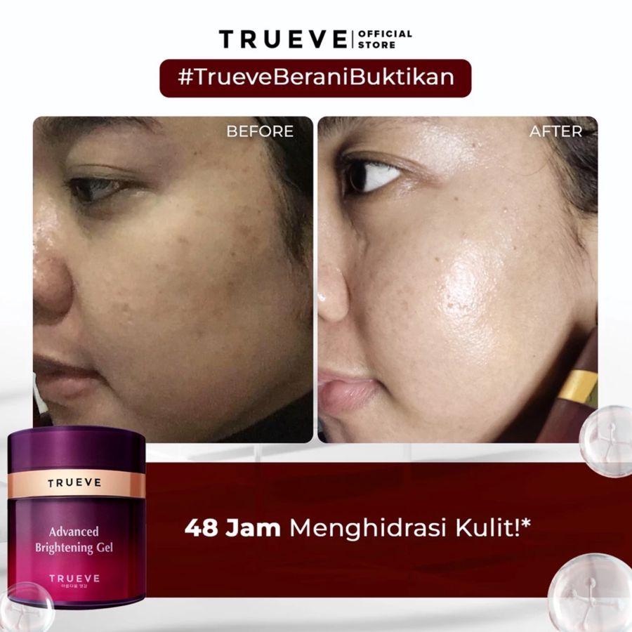 Trueve Advanced Brightening Gel 30ml