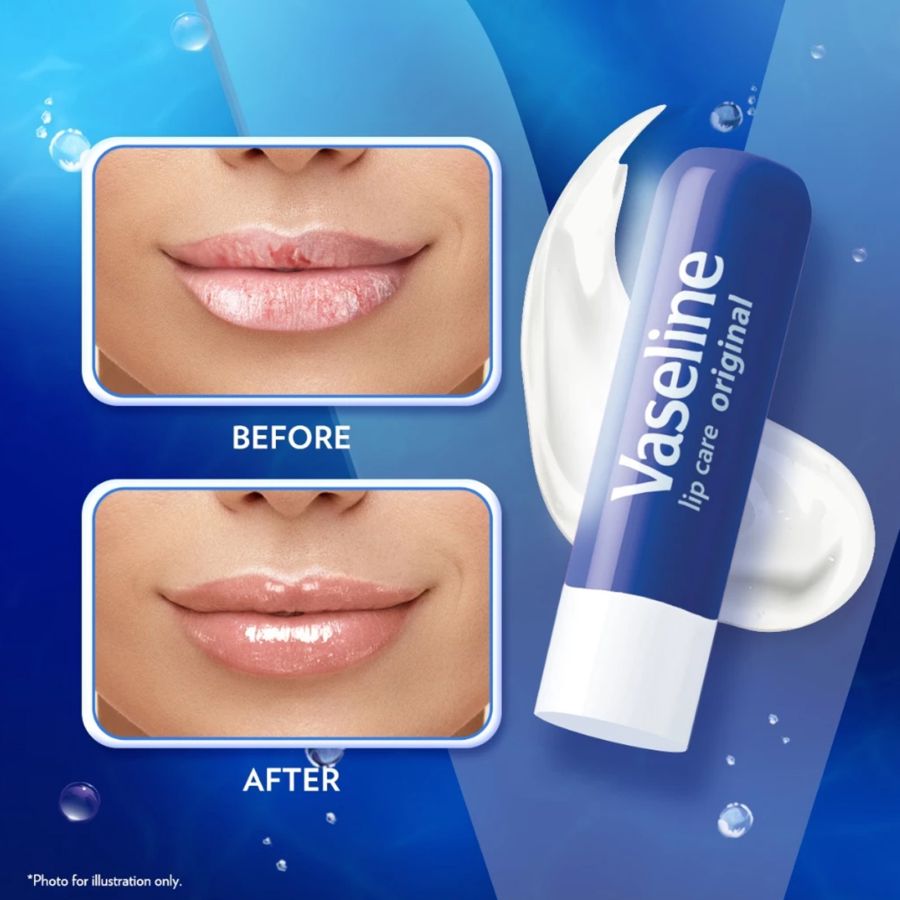 Vaseline Lip Therapy Original Lip Balm 4gram