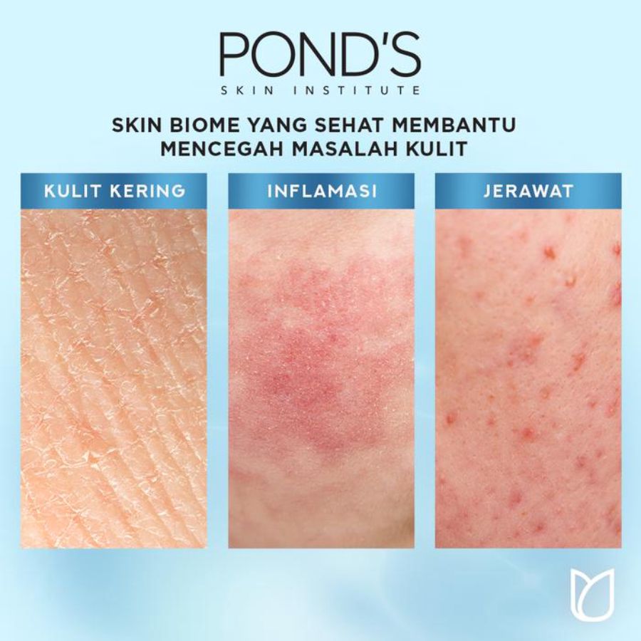 Ponds Hydra Miracle Ultra Light Biome Gel Pelembab Wajah 20gram