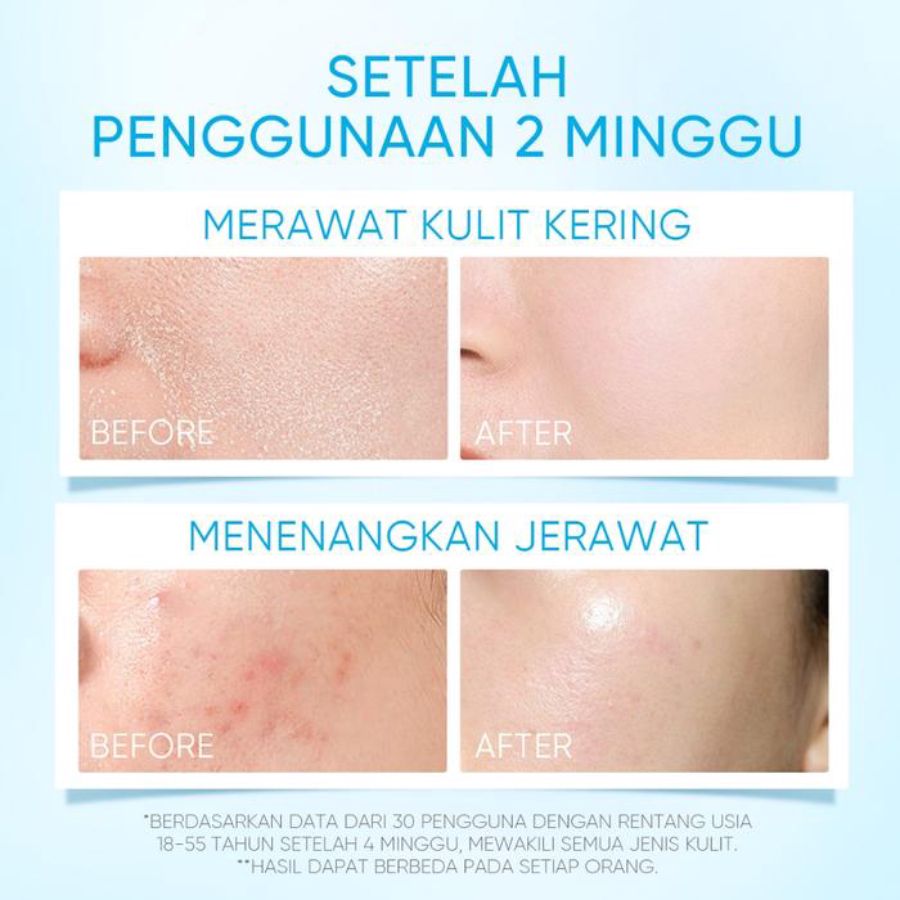 SKINTIFIC 5X Ceramide Barrier Moisturizer Gel 30gram