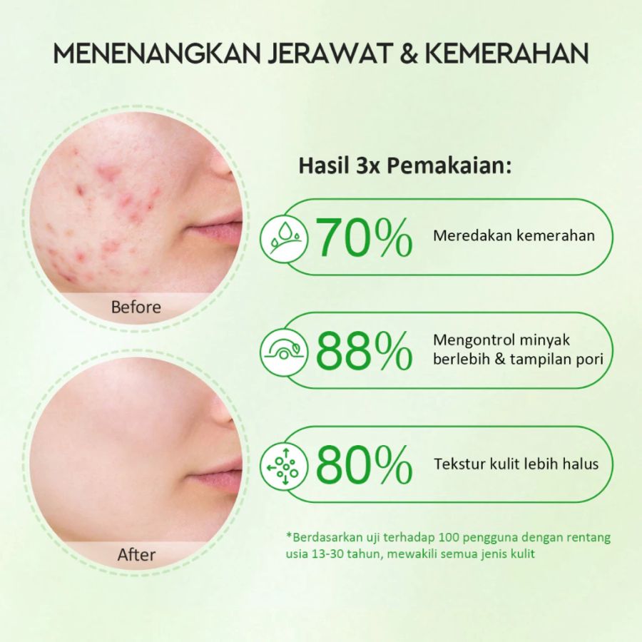 Glad2Glow Mugwort Clay Mask Stick Salicylic Acid Anti Pores & Acne 25gram