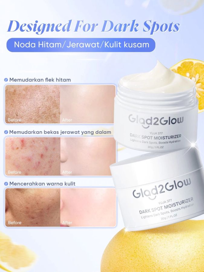 Glad2Glow Yuja Symwhite 377 Dark Spot Moisturizer 30gram