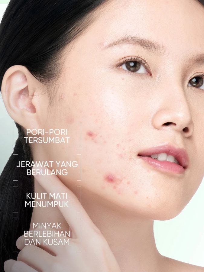 Skintific 2% Salicylic Acid Anti Acne Serum 50ml