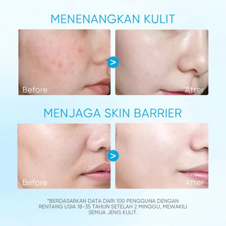 Skintific 5x Ceramide Soothing Toner Travel Size 20ml