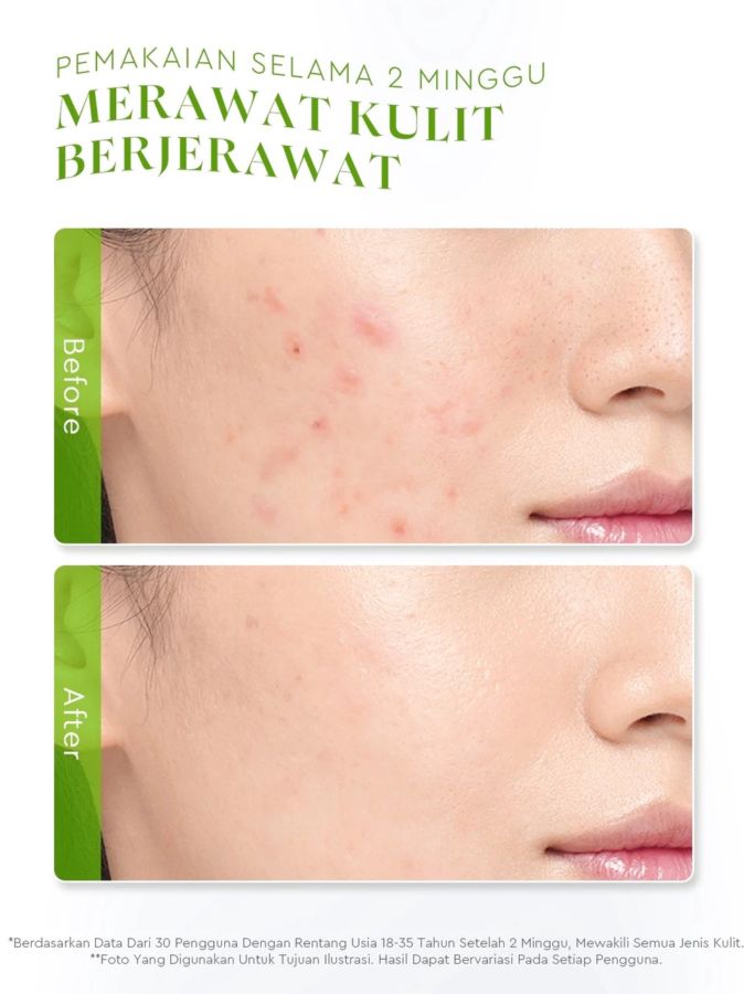 Glad2Glow Centella Allantoin Soothing Gel Moisturizer 30gram