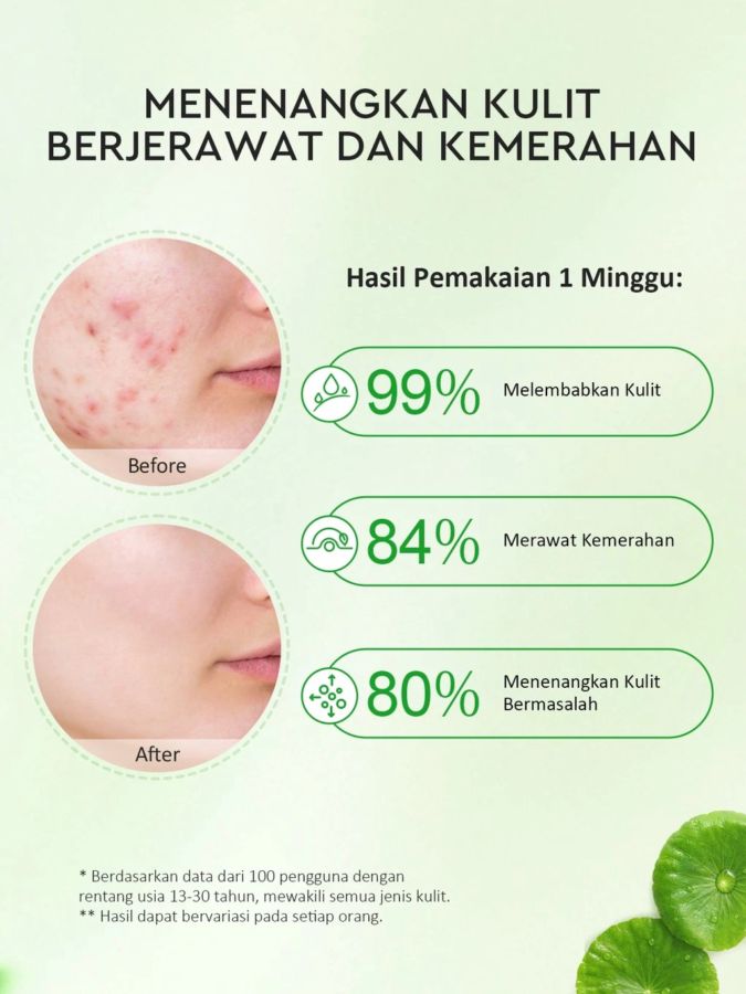 Glad2Glow Centella Allantoin Soothing Gel Moisturizer 30gram