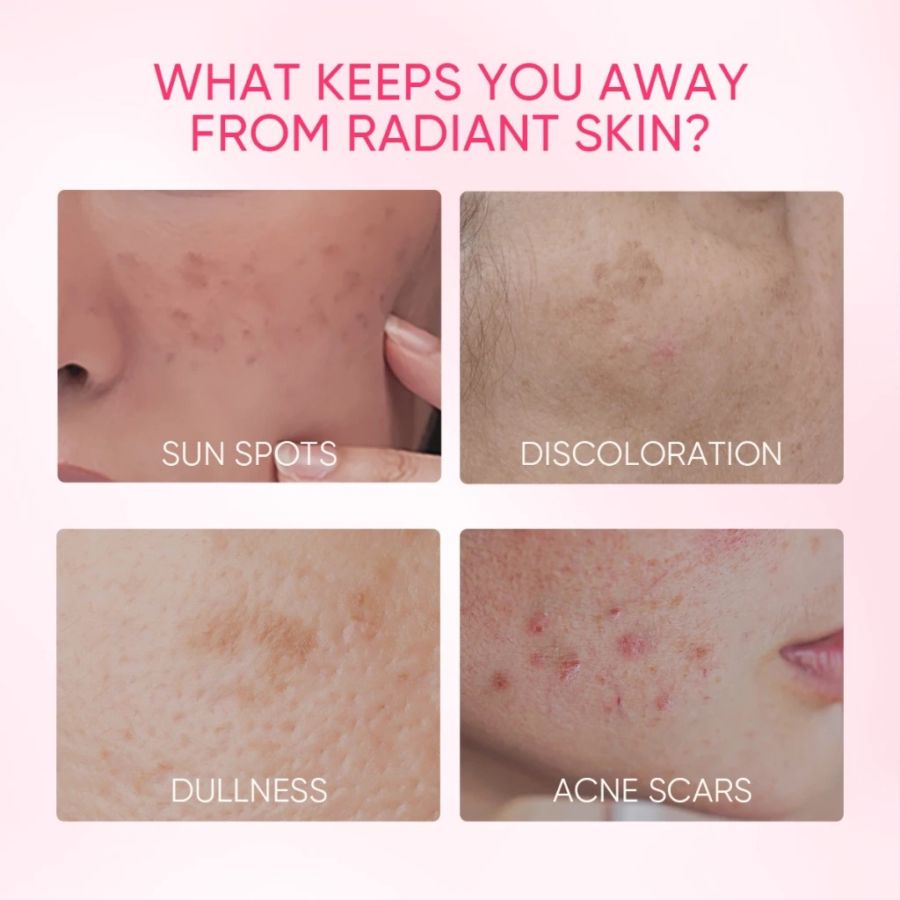 Skintific 10% Niacinamide Brightening Serum 50ml