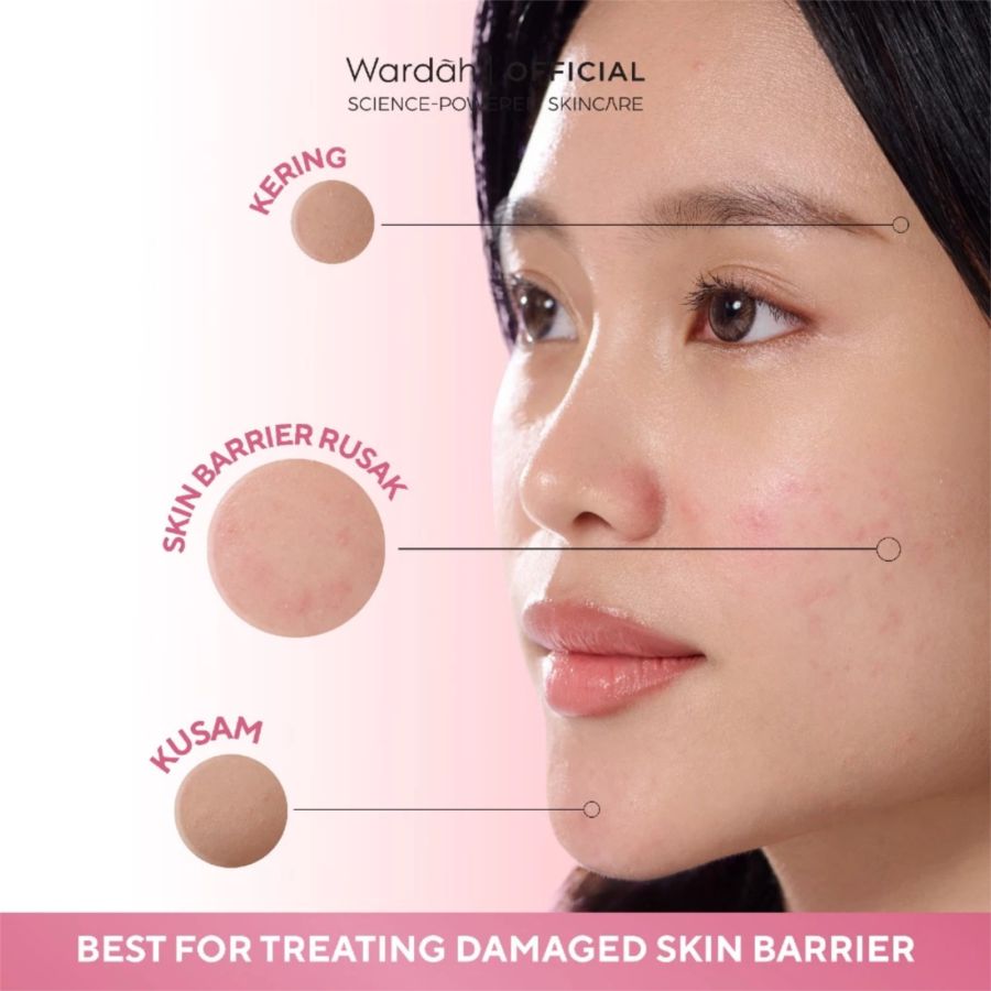 Wardah Hydra Rose NMF Amino + Pentavitin Barrier Replenish pH 5.5 Gel Cleanser 100ml