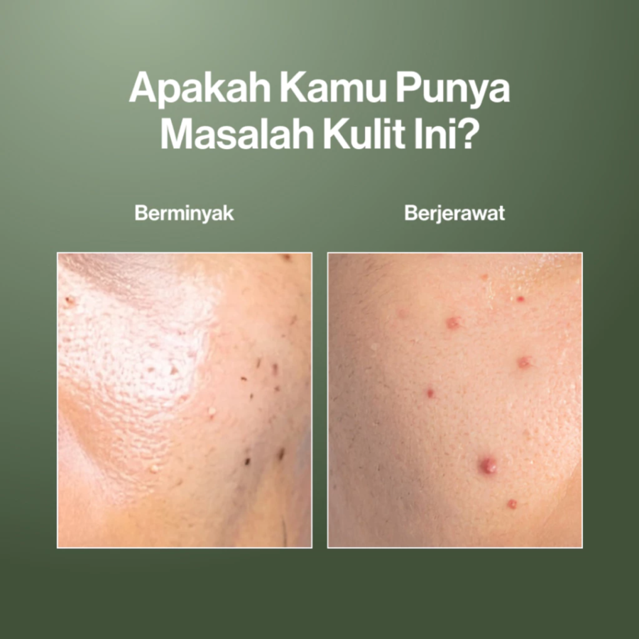 Kahf Oil and Acne Care Face Wash 100ml